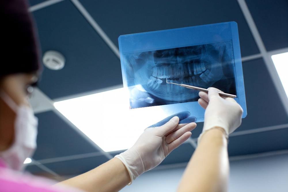 dentist-checks-x-ray-photo-mouth.jpg